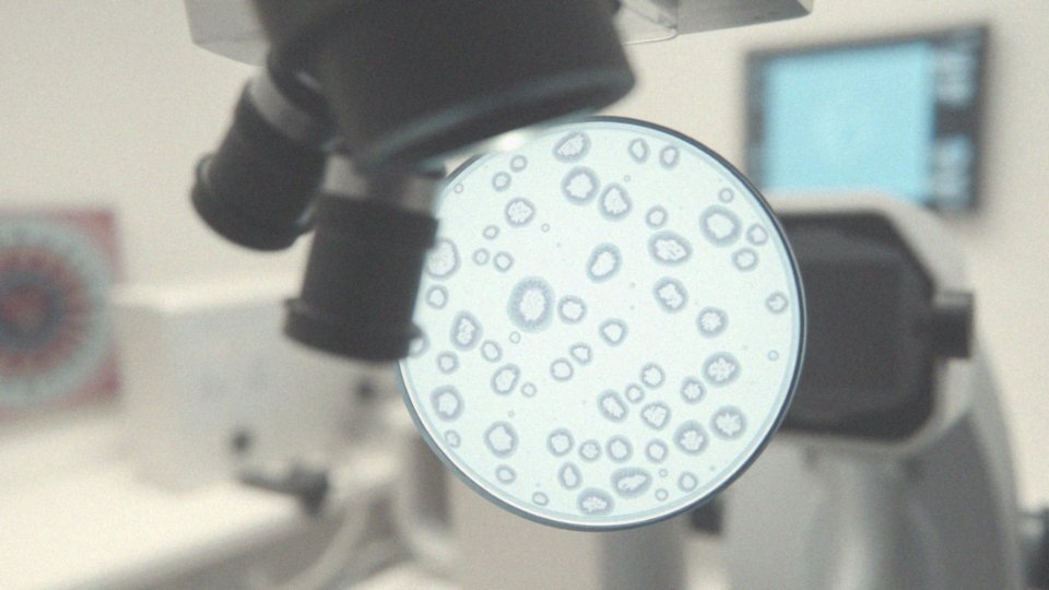 Jakie są standardy oceny wyników cytologii?