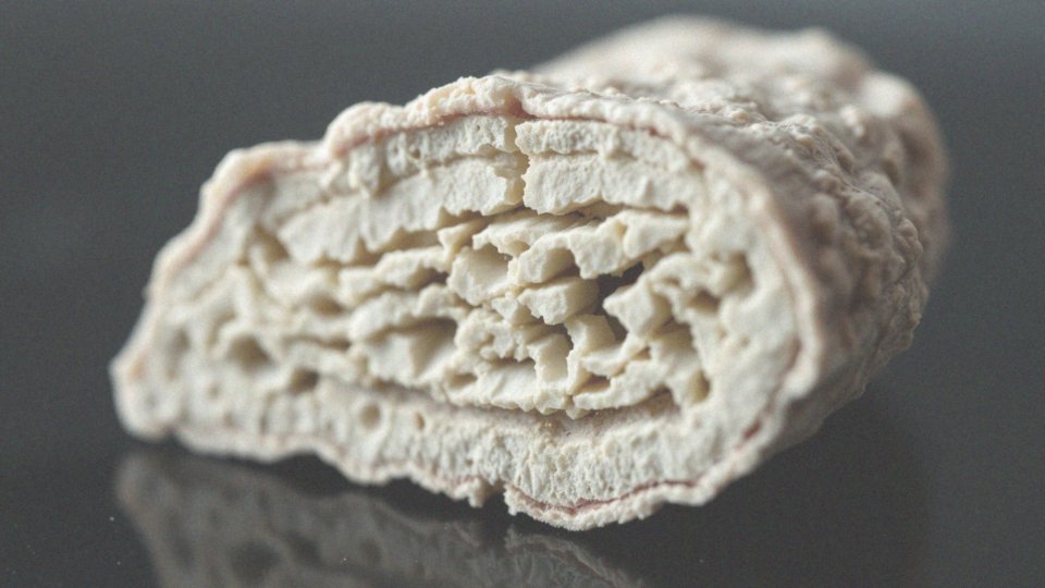 Jak związki hormonalne, takie jak estrogeny, wpływają na masę kostną?